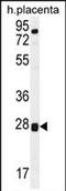 Torsin Family 2 Member A antibody, PA5-71651, Invitrogen Antibodies, Western Blot image 