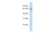 Zinc Finger Protein 256 antibody, A13698, Boster Biological Technology, Western Blot image 