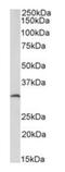 Complement Factor D antibody, orb334055, Biorbyt, Western Blot image 