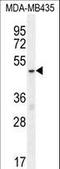 Methyl-CpG Binding Protein 2 antibody, LS-C164113, Lifespan Biosciences, Western Blot image 