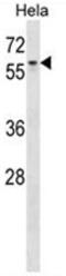 Hrb antibody, AP50110PU-N, Origene, Western Blot image 