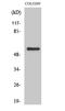 G Protein-Coupled Receptor Kinase 7 antibody, A09628, Boster Biological Technology, Western Blot image 