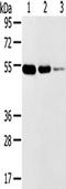 Transmembrane Serine Protease 11F antibody, TA351823, Origene, Western Blot image 