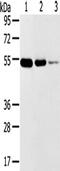 Transmembrane Serine Protease 11F antibody, TA351823, Origene, Western Blot image 