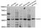 Gastrin Releasing Peptide Receptor antibody, STJ23875, St John