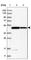 Hydroxyacyl-CoA Dehydrogenase Trifunctional Multienzyme Complex Subunit Beta antibody, HPA037540, Atlas Antibodies, Western Blot image 