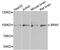 B-Raf Proto-Oncogene, Serine/Threonine Kinase antibody, abx006176, Abbexa, Western Blot image 
