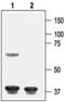 Potassium Voltage-Gated Channel Subfamily J Member 8 antibody, PA5-77622, Invitrogen Antibodies, Western Blot image 