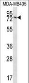 Sad1 And UNC84 Domain Containing 2 antibody, LS-C160438, Lifespan Biosciences, Western Blot image 