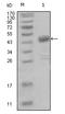 Discoidin Domain Receptor Tyrosine Kinase 1 antibody, AM20432SU-N, Origene, Western Blot image 