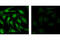 STAT3 antibody, 9145L, Cell Signaling Technology, Immunofluorescence image 