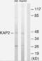 Protein Kinase CAMP-Dependent Type II Regulatory Subunit Alpha antibody, LS-C118784, Lifespan Biosciences, Western Blot image 