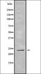 RAB19, Member RAS Oncogene Family antibody, orb338612, Biorbyt, Western Blot image 