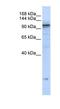 ATPase Sarcoplasmic/Endoplasmic Reticulum Ca2+ Transporting 2 antibody, NBP1-59203, Novus Biologicals, Western Blot image 