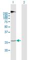 Transmembrane Protein 38A antibody, H00079041-B01P, Novus Biologicals, Western Blot image 