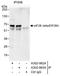 Eukaryotic Translation Initiation Factor 2B Subunit Delta antibody, A302-983A, Bethyl Labs, Immunoprecipitation image 