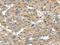 Tumor Suppressor Candidate 1 antibody, CSB-PA290881, Cusabio, Immunohistochemistry paraffin image 