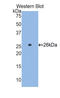 Glutamate-Cysteine Ligase Catalytic Subunit antibody, LS-C294230, Lifespan Biosciences, Western Blot image 