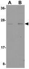 Placenta-specific protein 4 antibody, GTX85149, GeneTex, Western Blot image 