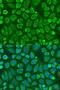 Sorting Nexin 32 antibody, 23-346, ProSci, Immunofluorescence image 