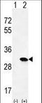 HRas Proto-Oncogene, GTPase antibody, LS-C165008, Lifespan Biosciences, Western Blot image 