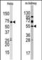 Jumonji Domain Containing 4 antibody, PA5-11152, Invitrogen Antibodies, Western Blot image 