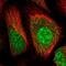Huntingtin antibody, NBP1-89710, Novus Biologicals, Immunocytochemistry image 