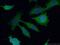 ENAH Actin Regulator antibody, 26421-1-AP, Proteintech Group, Immunofluorescence image 