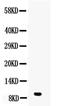 Diazepam Binding Inhibitor, Acyl-CoA Binding Protein antibody, PA5-79138, Invitrogen Antibodies, Western Blot image 