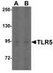 Toll Like Receptor 5 antibody, A00462-1, Boster Biological Technology, Western Blot image 