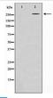 Acetyl-CoA Carboxylase Alpha antibody, LS-C417619, Lifespan Biosciences, Western Blot image 