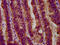 Glucosylceramidase Beta antibody, CSB-PA009289LA01HU, Cusabio, Immunohistochemistry frozen image 
