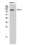 Adhesion G Protein-Coupled Receptor F4 antibody, A14764, Boster Biological Technology, Western Blot image 