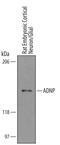 Activity Dependent Neuroprotector Homeobox antibody, AF5919, R&D Systems, Western Blot image 