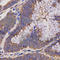 Epoxide Hydrolase 2 antibody, A1885, ABclonal Technology, Immunohistochemistry paraffin image 
