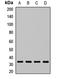 Actin Related Protein 2/3 Complex Subunit 2 antibody, LS-C668924, Lifespan Biosciences, Western Blot image 