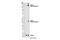 CCR4-NOT Transcription Complex Subunit 3 antibody, 13300S, Cell Signaling Technology, Western Blot image 