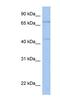 Immunoglobulin Superfamily Containing Leucine Rich Repeat 2 antibody, NBP1-91341, Novus Biologicals, Western Blot image 