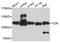 CD6 Molecule antibody, A8107, ABclonal Technology, Western Blot image 