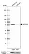 Inosine Monophosphate Dehydrogenase 2 antibody, HPA001400, Atlas Antibodies, Western Blot image 