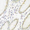 Pyrroline-5-Carboxylate Reductase 1 antibody, 14-935, ProSci, Immunohistochemistry frozen image 