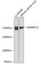 SWI/SNF Related, Matrix Associated, Actin Dependent Regulator Of Chromatin Subfamily C Member 2 antibody, 18-417, ProSci, Western Blot image 