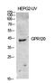 Free Fatty Acid Receptor 4 antibody, PA5-50973, Invitrogen Antibodies, Western Blot image 