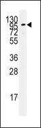 Adenylate Cyclase 2 antibody, PA5-12328, Invitrogen Antibodies, Western Blot image 