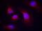 Spleen Associated Tyrosine Kinase antibody, PA5-37746, Invitrogen Antibodies, Immunofluorescence image 