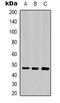 Keratin 17 antibody, LS-B16512, Lifespan Biosciences, Western Blot image 