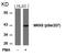 Mitogen-Activated Protein Kinase Kinase 6 antibody, GTX50204, GeneTex, Western Blot image 