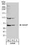 WAS antibody, A300-581A, Bethyl Labs, Western Blot image 