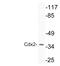 Caudal Type Homeobox 2 antibody, LS-C177108, Lifespan Biosciences, Western Blot image 