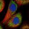 Acid Phosphatase 7, Tartrate Resistant (Putative) antibody, PA5-59817, Invitrogen Antibodies, Immunofluorescence image 